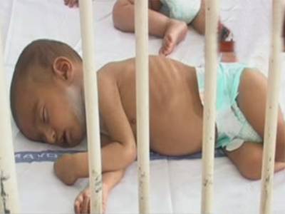 لاہور میں خسرہ سےمتاثرہ دو بچے میو اسپتال میں دم توڑ گئے.