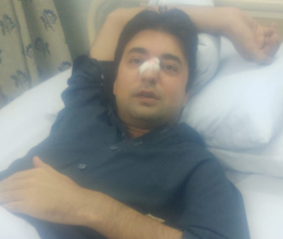 وزیر مملکت مراد سعید شیشہ لگنے سے زخمی، چہرے پر چار ٹانکے