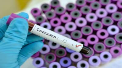 سندھ میں کورونا وائرس کے87 کیسز، ملک بھر میں تعداد 105 ہوگئی