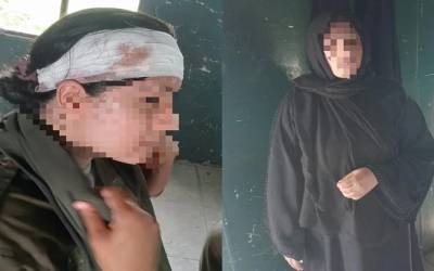 کار سوار خاتون نے تلخ کلامی پر لیڈی اہلکار کا بوتل سے سر پھاڑ دیا۔