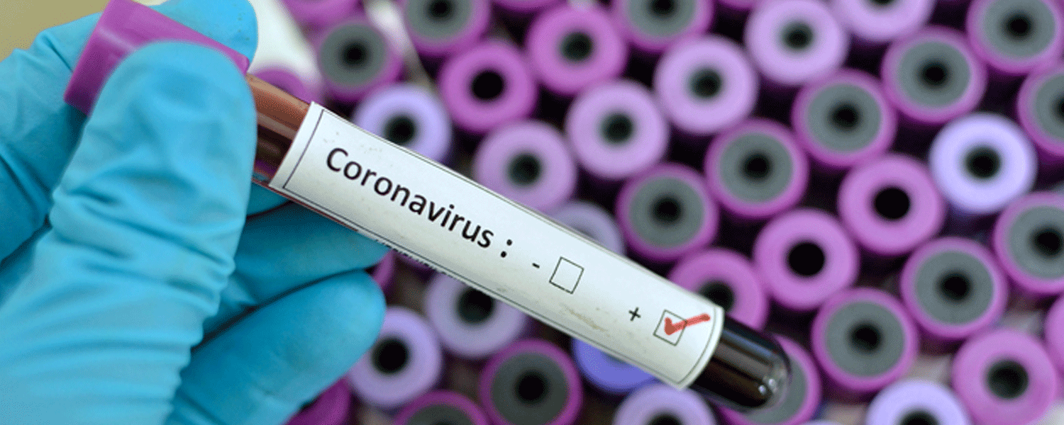 سائنس دانوں کا کرونا وائرس کا علاج دریافت کرنے کا دعویٰ